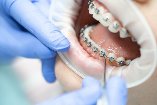 orthodontie