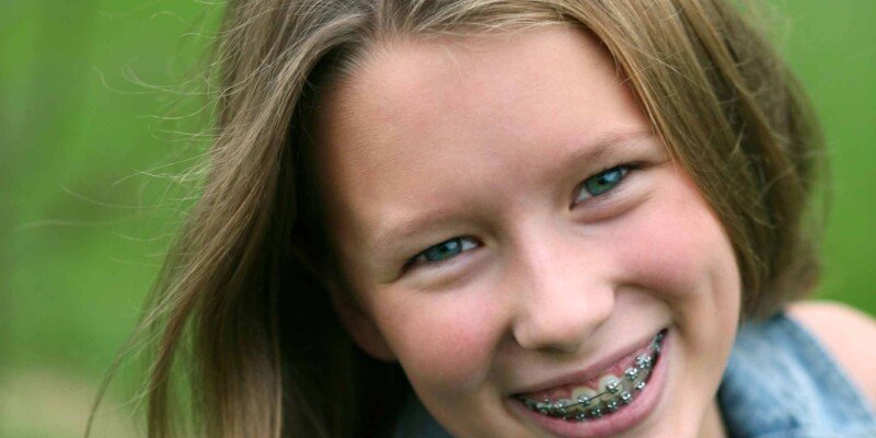 Kind orthodontie 2